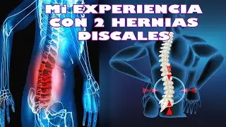 MI EXPERIENCIA CON 2 HERNIAS DISCALES con 26 AÑOS