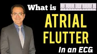 Atrial Flutter ECG Explained, Practice ECG's, Treatment, Symptoms, ECG Interpretation Lecture, USMLE