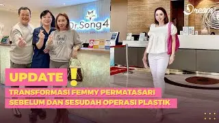 Transformasi Femmy Permatasari Sebelum dan Sesudah Operasi Plastik