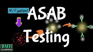 ASAB Testing | Antisperm Antibody Testing | Direct ASAB Testing | Indirect ASAB Testing |