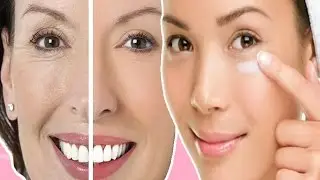 How to remove wrinkles under the eyes? Mimic wrinkles around the eyes. Olesya Selezneva