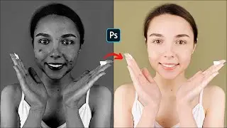 Enable “X-Ray” to Remove Blemishes in Photoshop 2022