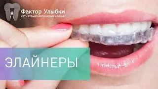 Прозрачные капы - элайнеры. Как выровнять зубы без брекетов?