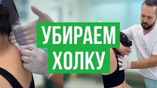 Лечение холки: как избавиться от горбика на шее