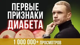 7 главных признаков диабета / Как понять что у вас преддиабет?