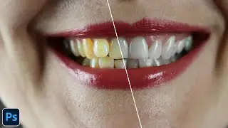 How to Transform Yellow Teeth into White and Bright in Photoshop