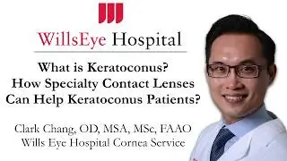 What is Keratoconus? How Specialty Contact Lenses Can Help Keratoconus Patients?