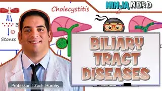 Biliary Tract Diseases | Clinical Medicine
