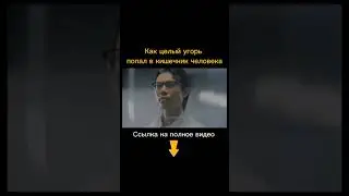 То что Вытащили Из Кишечника Шокировало Всех