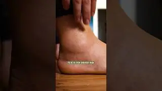 What To Do If You Have An Ankle Sprain 🦶 (See Description For Episode 🎙️) #thefootcollective