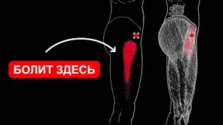 SURVIVE THE SIDE SURFACE OF THE HIP AND THE CELEBRED JOINT 🔴