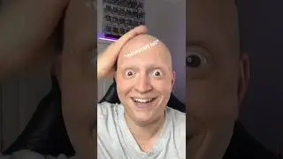 The toy called me a bald freak 