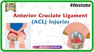 Anterior Cruciate Ligament (ACL) Injuries