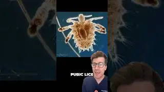 Pubic lice explained 