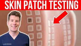 ALLERGY TESTING: Doctor explains the Skin Patch Test