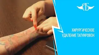 Хирургическое удаление татуировок