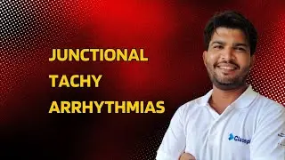 Junctional Tachycardia | Types | Mechanism |