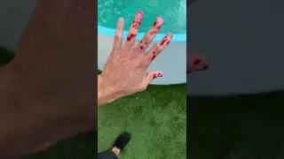 WHEN JAWS Attack you p.2