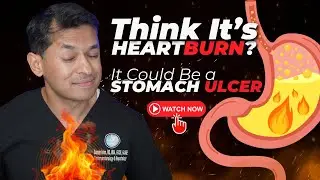 Think It’s Heartburn? It Could Be a Stomach Ulcer – Here’s What to Watch For!