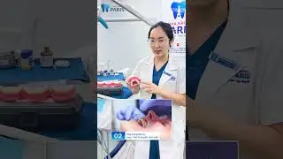 Các vấn đề thường gặp trong quá trình chỉnh nha #nhakhoaparis #niengrang #dentist #nhakhoauytin