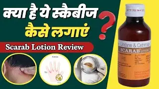 Scarab Lotion Kaise Lagaye | Lindane And Cetrimide Lotion | Scabies Aur Khujli Ke Liye Scarab Lotion