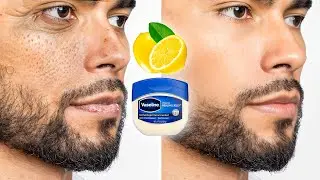 How To Fix Your Skin Problems For Men Over 30