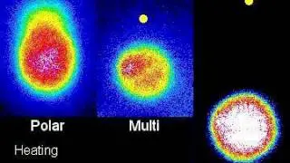 Local Heating Changes Intracellular Ca2+ Levels