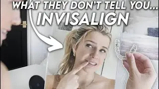 Things I Wish I Knew Before Getting Invisalign... Is It Worth It?