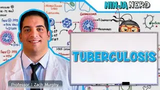 Tuberculosis