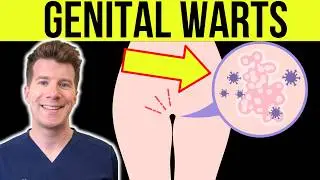 Doctor explains GENITAL WARTS | Causes, Symptoms, Treatment, Prevention