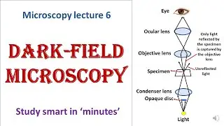 Dark-field microscope | working principle | Advantages, disadvantages | Microscopy lecture 6