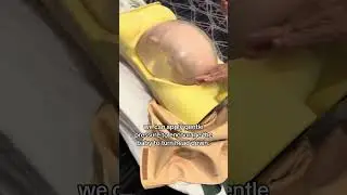 How we flip a breech baby! 