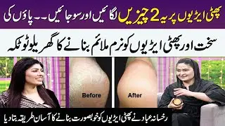 Easy Home Remedies for Cracked Heels | Remove Cracked Heels In Over Night | Rukhsana | Meri Saheli