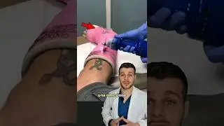 Come avviene una rimozione di gesso in ospedale 🏥 