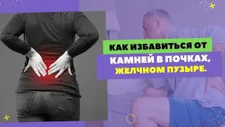 КАК ИЗБАВИТЬСЯ ОТ КАМНЕЙ В ЖЕЛЧНОМ ПУЗЫРЕ. ✅Отзыв пациента. [Шишова О.И.]