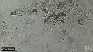 Watch these protists extend their "necks" as they scout for food | Science News