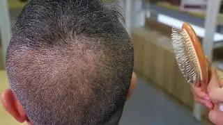NATURAL SPRAY FROM GRAY HAIR
