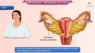 Menopause Symptoms - Ways to Deal With it