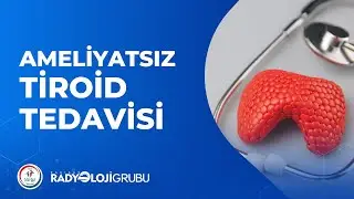 Ameliyatsız Tiroid Nodül Tedavisi I Radyoloji Grubu