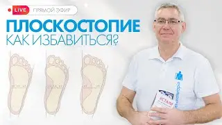 Плоскостопие у детей и взрослых: диагностика, лечение и упражнения