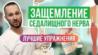 Разблокировать седалищный нерв - упражнения