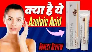 Azelaic Acid Cream For Face | Rosacea Skin Care | Ezanic Cream Review | Melasma Pigmentation Cream