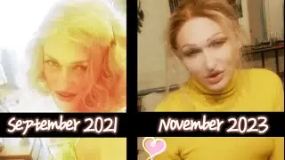 TWO YEARS OF MAGIC✨My real timeline story of transformation from gender change man to woman