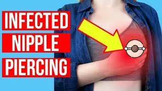 How to treat an INFECTED NIPPLE PIERCING | Plus infection prevention