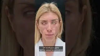 Изуродовали модель