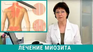 Миозит: симптомы и лечение миозита мышц