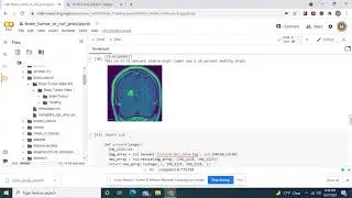 Build an very accurate Convolutional Neural Network that detects Brain Tumors