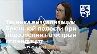 Техника визуализации брюшной полости при подозрении на острый аппендицит