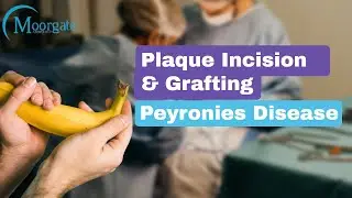 Plaque Incision And Grafting Surgery | Peyronies Disease