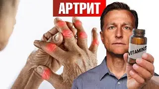 Лучший витамин от артрита (и это НЕ витамин Д) 👀